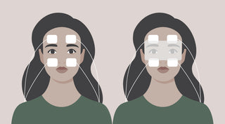 Illustration of microcurrent electrode placement on face