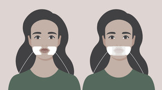 Illustration of microcurrent electrode placement  around mouthon face