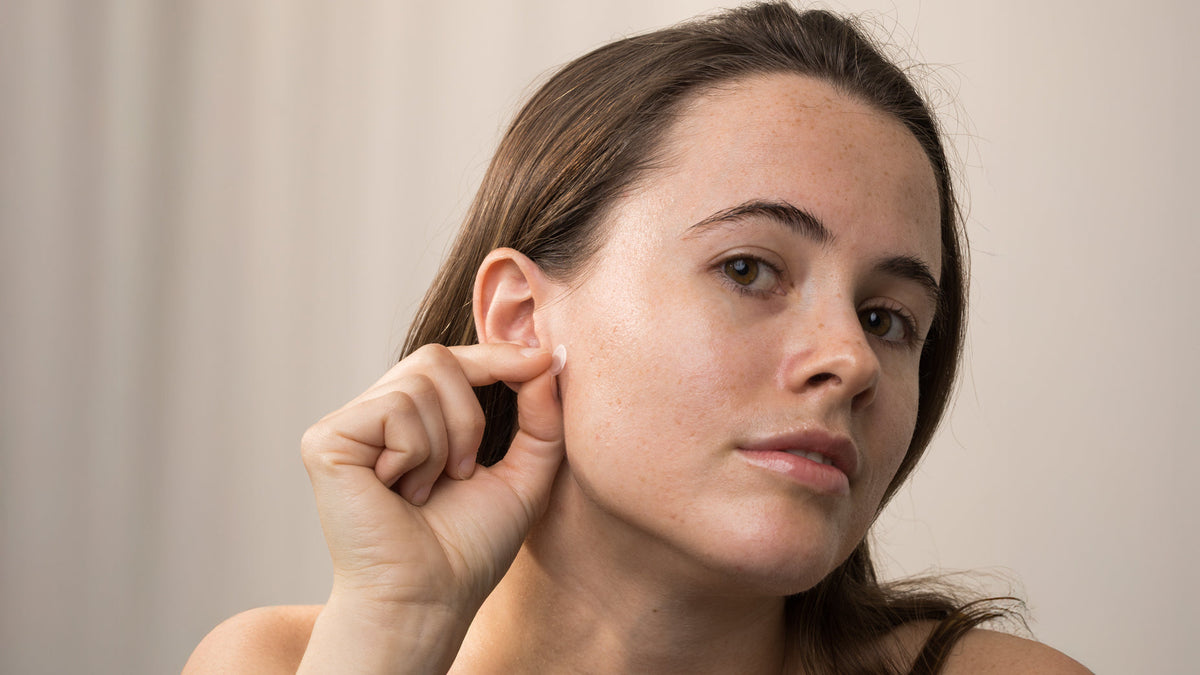 Skin Purging 101 – Why Your Skin Freaks Out (and Why That’s a Good Thing)