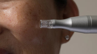 What Is Microneedling and How To Microneedle at Home - Art of Skin Care