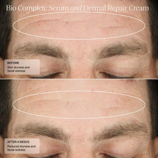 Sente Labs Dermal Repair Duo