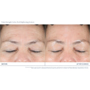 iS Clinical Extra Strength Active Peel Brightening System
