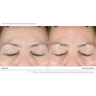 iS Clinical Extra Strength Active Peel Brightening System