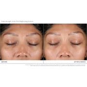 iS Clinical Extra Strength Active Peel Brightening System