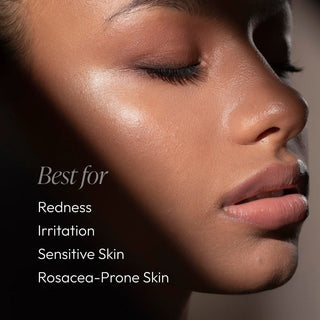 Close-up portrait with text overlay — Circadia Aloe & Calendula Calming Mist is best for redness, irritation, sensitive skin, and rosacea-prone skin
