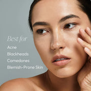 Woman with clear balanced skin showing Circadia Cleansing Gel with Salicylic Acid is best for acne, blackheads, comedones, and blemish-prone skin