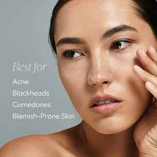 Woman with clear balanced skin showing Circadia Cleansing Gel with Salicylic Acid is best for acne, blackheads, comedones, and blemish-prone skin