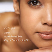 Close-up of woman with clear, balanced skin showing Circadia Daytime Control Oil Reducer is best for acne, acne-prone, oily, and combination skin