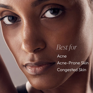 Close-up portrait with text overlay — Circadia Nighttime Control Acne Treatment Lotion is best for acne, acne-prone skin, and congested skin