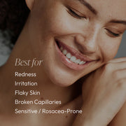 Smiling woman with calm, even skin showing Circadia Tranquili-Cream Calming Lotion is best for redness, irritation, flaky skin, broken capillaries, and sensitive or rosacea-prone skin