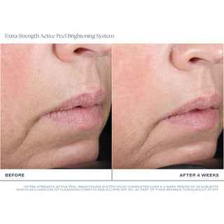iS Clinical Extra Strength Active Peel Brightening System