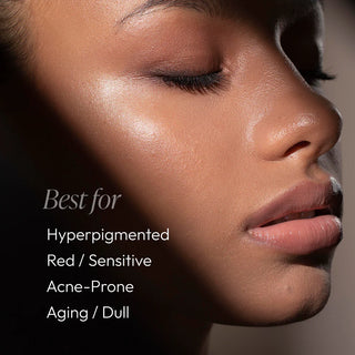 Woman with even radiant skin showing Circadia Serum 71 Renewal Serum is best for hyperpigmented, red and sensitive, acne-prone, and aging or dull skin