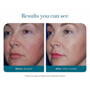 Colorescience Barrier Pro Serum Spray before and after comparison showing improved skin tone, reduced blotchiness and enhanced radiance after 4 weeks of use, courtesy of Robertson Cosmetic Center