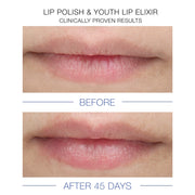 Clinical before and after close-up photos showing visibly fuller and more hydrated lips after 45 days of iS Clinical Lip Polish and Youth Lip Elixir use, clinically proven results