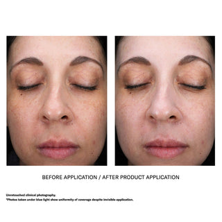 Unretouched clinical before and after photos showing uniform invisible coverage of Skinbetter Science sunbetter SHEER SPF 70 Sunscreen Lotion under visible light