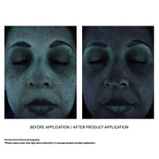 Unretouched clinical before and after blue light photos demonstrating uniform SPF coverage of Skinbetter Science sunbetter SHEER SPF 70 Sunscreen Lotion despite invisible application