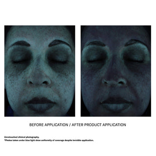Unretouched clinical before and after blue light photos demonstrating uniform SPF coverage of Skinbetter Science sunbetter SHEER SPF 70 Sunscreen Lotion despite invisible application