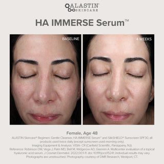ALASTIN HA IMMERSE Serum before and after face photos at baseline and 4 weeks