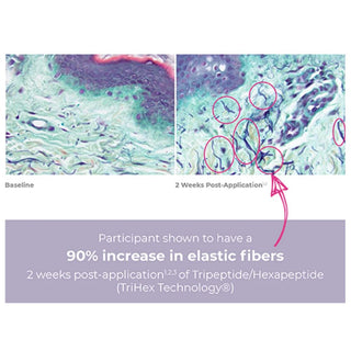 Microscope images showing 90% increase in elastic fibers after 2 weeks of use