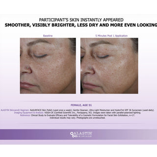 Before and after face photos showing smoother, brighter skin after one application