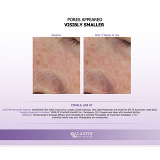 Before and after close-up showing visibly smaller pores after using Skin Polish