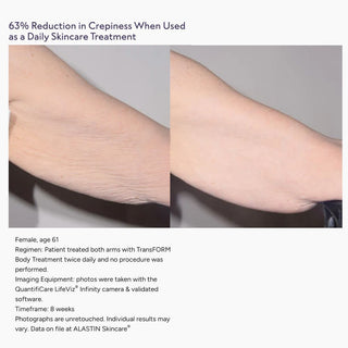 Before and after arm showing 63% crepiness reduction after 8 weeks using TransFORM Treatment