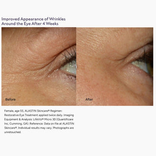 Before and after 4 weeks of ALASTIN Restorative Eye Complex: visibly fewer crow’s feet wrinkles on a 55-year-old woman