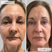 Side-by-side before-and-after showing a woman with visibly reduced fine lines, wrinkles, and improved skin firmness after using the Omnilux Contour Face LED mask.