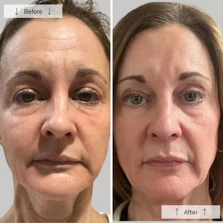 Side-by-side before-and-after showing a woman with visibly reduced fine lines, wrinkles, and improved skin firmness after using the Omnilux Contour Face LED mask.