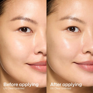 Before and after applying EltaMD UV Clear Untinted SPF 46, seamless finish on acne and rosacea-prone skin
