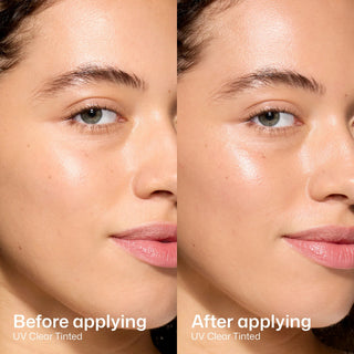 Before and after applying EltaMD UV Clear Tinted SPF 46, even skin tone and clearer complexion