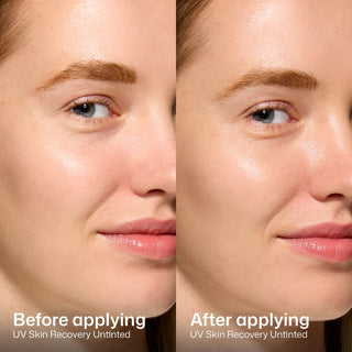Before and after applying EltaMD UV Skin Recovery SPF 50, no white cast seamless finish on sensitive skin