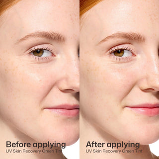 Before and after applying EltaMD UV Skin Recovery Green Tinted SPF 50, seamless finish on sensitive skin