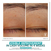 FACTORFIVE Lash Brow Growth Serum before and after eyelash comparison showing visible improvement in lash volume and density from baseline Day 0 to Week 4 with twice daily application