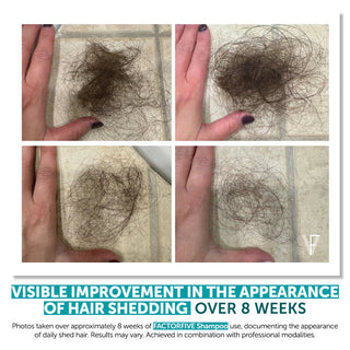 FACTORFIVE Shampoo before and after comparison showing visible reduction in daily hair shedding over 8 weeks of use with Advanced Haircare System