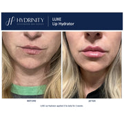 Hydrinity Luxe Lip Hydrator before and after comparison showing visibly fuller, smoother, and more hydrated lips after 2 weeks of use applied 3 to 5 times daily