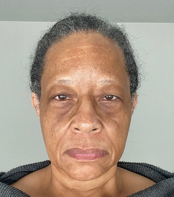 Healthy Aging