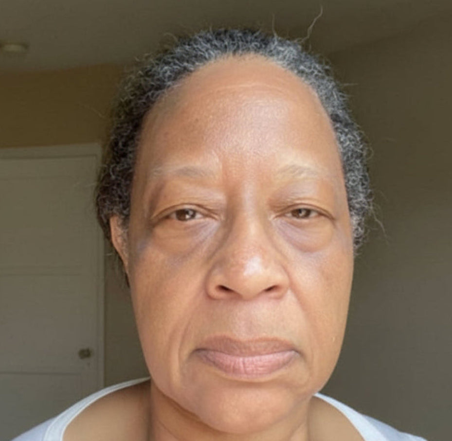 Healthy Aging