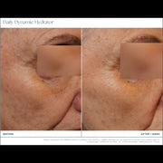 Clinical before and after close-up photos showing improved skin texture and reduced fine lines around the eye area after 1 week of iS Clinical Daily Dynamic Hydrator use