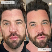 Side-by-side before-and-after showing a bearded man with visibly reduced redness, fine lines, and more even skin tone after using the Omnilux Men LED mask.