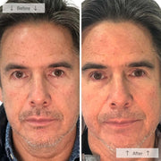 Side-by-side before-and-after showing a man with visibly reduced fine lines and more even skin tone after using the Omnilux Men LED mask.