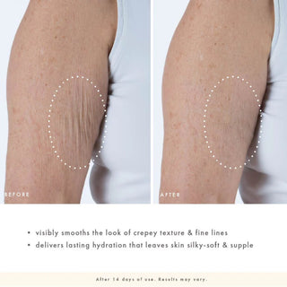 Side-by-side before-and-after close-up of an upper arm showing visibly reduced crepey texture and fine lines after 14 days of use of Farmhouse Fresh Moon Dip Back to Youth Ageless Body Mousse, with dotted circles highlighting the treatment area and benefit claims noting it visibly smooths crepey texture and fine lines and delivers lasting hydration that leaves skin silky-soft and supple. Results may vary.