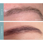 NeoGenesis NeoBrow Growth Serum before and after eyebrow comparison showing visibly fuller and denser brow hair growth from Day 0 to 1 month of use