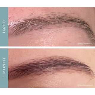 NeoGenesis NeoBrow Growth Serum before and after eyebrow comparison showing visibly fuller and denser brow hair growth from Day 0 to 1 month of use
