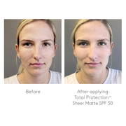 Before and after applying Colorescience Total Protection Sheer Matte SPF 30 on fair skin tone showing reduced shine and more refined skin texture.