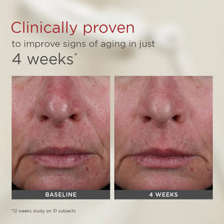 EltaMD UV AOX Elements SPF 50 clinical before and after – proven improvement in signs of aging after 4 weeks daily use