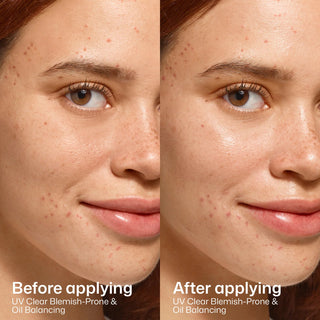 EltaMD UV Clear SPF 50 before and after applying – reduced shine and smoother skin for acne-prone and oily skin