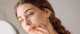 Young woman examining acne on her face — Art of Skin Care Clear Skin Coaching