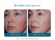 Colorescience Barrier Pro Serum Spray - Art of Skin Care