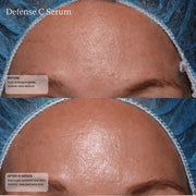 Face Reality Defense C Serum before and after 12 weeks - forehead showing reduced pore size and improved skin radiance and texture - available at The Art of Skin Care